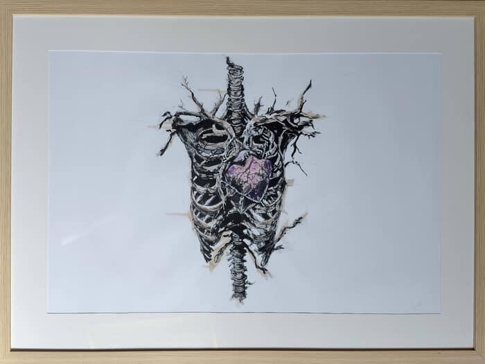 Artrhodèse des coeurs by Julie Balsaux